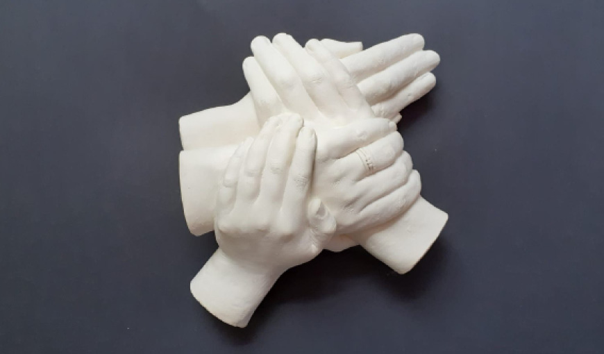 Alan Young - Hand Cast - The Myton Hospices - Warwick - Coventry - Rugby - Leamington Spa - Warwick Myton Hospice